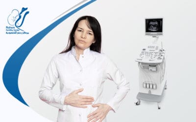 تجربتي مع متابعة التبويض بالسونار
