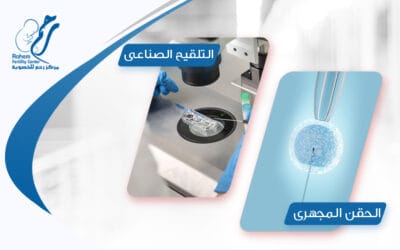 تعرفي على الفرق بين الحقن المجهرى والتلقيح الصناعى
