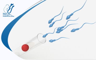 حجم البويضات المناسب لطفل الأنابيب: تعرفي على شروط نجاح الإخصاب المجهري