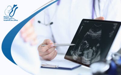 فحص الاجنة قبل الارجاع