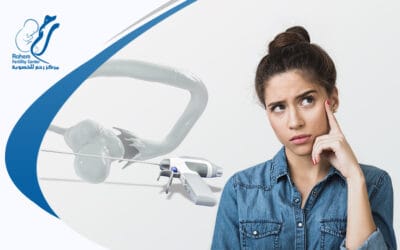 نسبة الحمل بعد عملية المنظار لتكيس المبايض