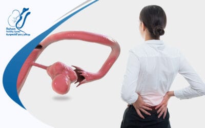 أسئلة وإجابات، هل التكيس يسبب الم في الظهر؟ وهل يُظهر حبوب الوجه؟