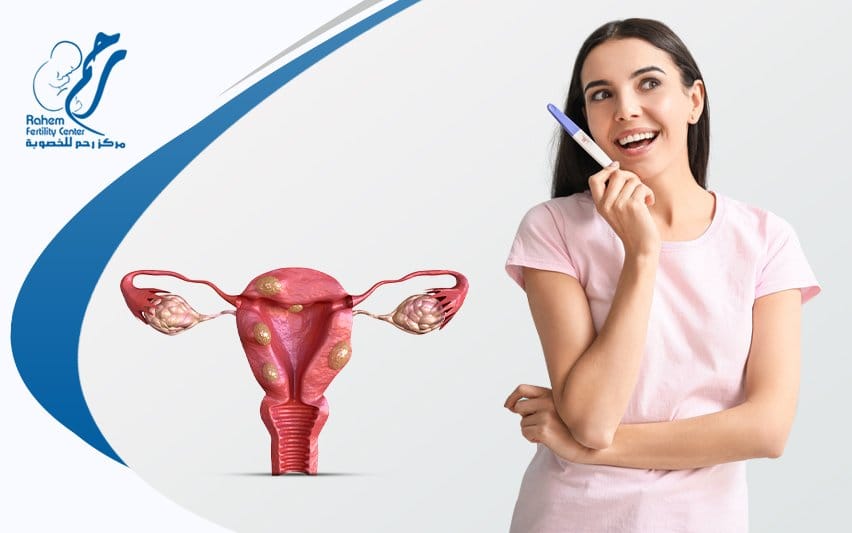 هل تزداد نسبة الحمل بعد استئصال الورم الليفي استئصال الورم الليفي